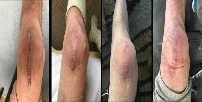 Wound Healing Support Before & After