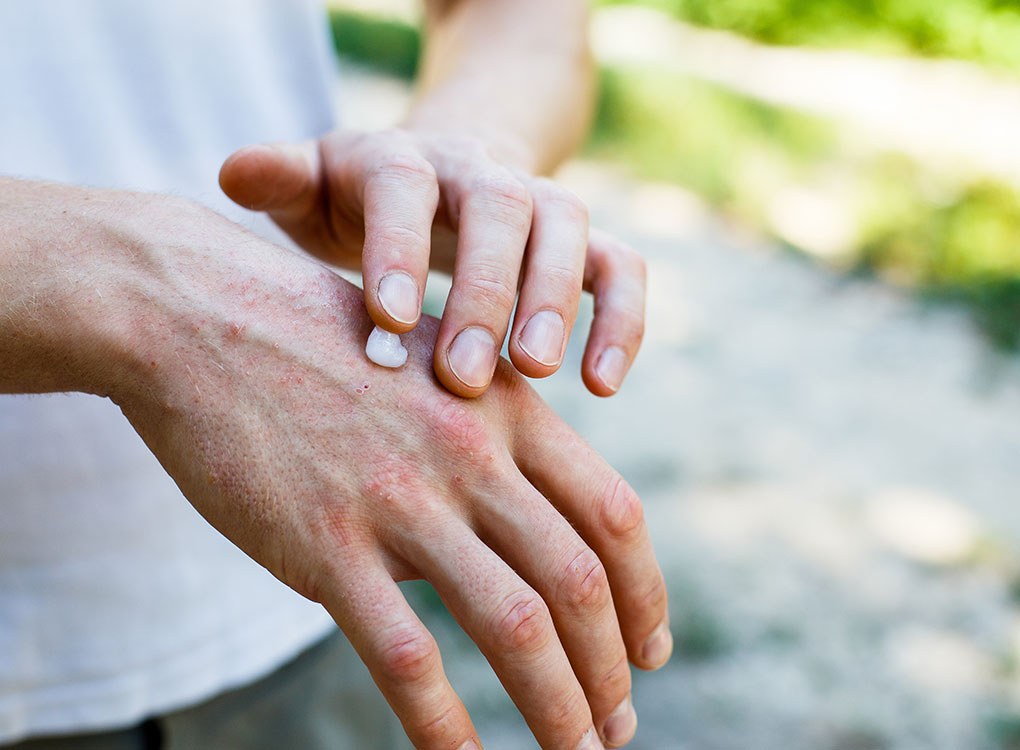 Hand Rejuvenation: Hands Look 10 Years Younger with Three Simple Steps